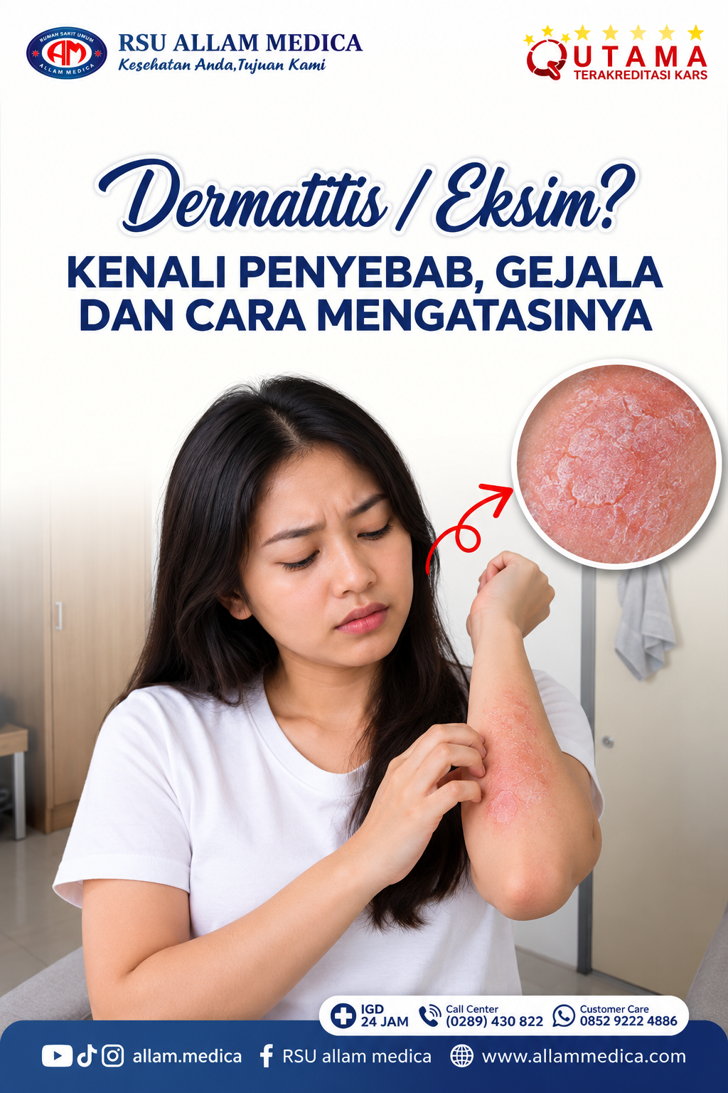 Dermatitis Atopik (Eksim): Kenali, Rawat, dan Cara Mengatasinya
